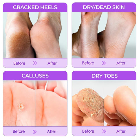 Optimum Wellness™ Peeling Foot Masks | Get Baby-Soft Smooth Radiant Feet